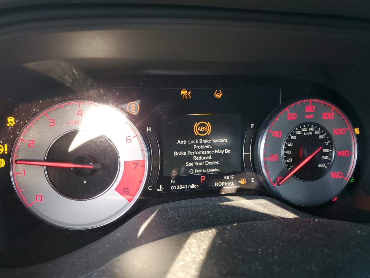 Acura TLX A-spec Image 5